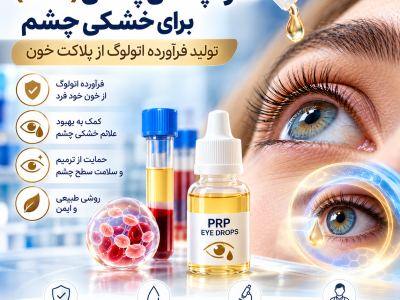 PRP Eye Drops for Dry Eye
